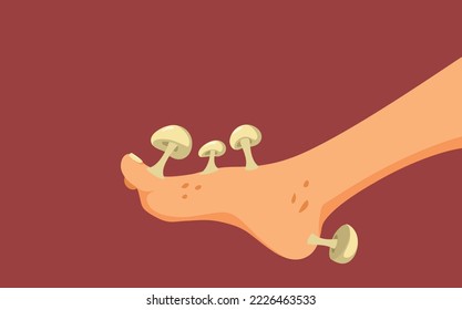 Foot with Fungus Problem Concept Cartoon Illustration. Person dealing with mycosis and tinea pedis skin problems