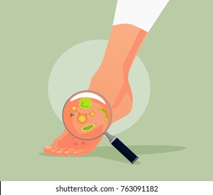 Foot Fungus. Vector Flat Cartoon Illustration