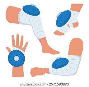 Foot, hand, arm, leg with ice pack applied to injured area to reduce inflammation and alleviate pain. First aid. Vector illustration