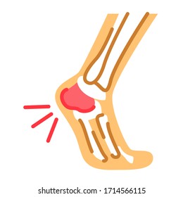 Foot heel pain flat color icon. Heel spur, calcaneal apophysitis, plantar fasciitis, disease concept. Sign for web page, mobile app, button, logo. Vector isolated button.