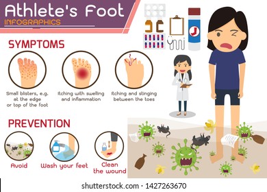 Athlete’s foot or Hong kong foot Disease Infographics. wounds on foot. symptoms and prevention Athlete's foot. health and medicine cartoon vector illustration.