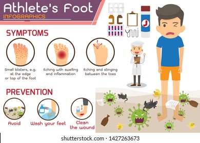 Athlete’s foot or Hong kong foot Disease Infographics. wounds on foot. symptoms and prevention Athlete's foot. health and medicine cartoon vector illustration.