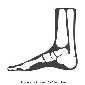 Foot Icon Of Radiography And X-ray Concept Vector For Landing Page. Leg Trauma, Pain, Osteoporosis Illustration. 