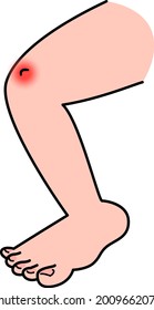 Biss, juckender, geschwollener Illustrationsmaterial