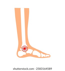 Foot Joint Anatomy Medical Illustration  