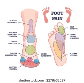 Fußschmerzen verursacht aus Zonen Diagnose und schmerzhaften Flecken Flächen Umriss-Diagramm. Bezeichnetes Bildungsprogramm mit medizinischer Krankheit, Krankheit oder Traumadiagnose, Vektorgrafik. Tendonitis, Bursitis