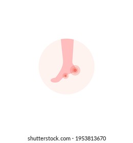 Foot pain vector icon isolated white background.