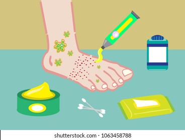 A Foot Problem with ointments or health care tools. Editable Clip Art.