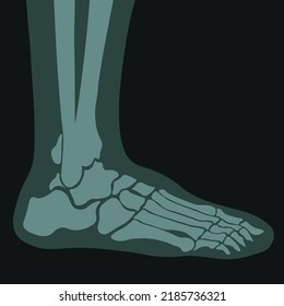 Foot roentgen scan, x ray of human ankle, examination of joints and bones condition. Clinics and hospitals, healthcare and treatment of trauma, diseases and illnesses pain. Vector in flat style