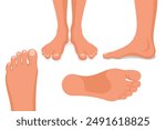 Foot set. Collection leg. Human feet. Body ankle elements. Bare legs positions isolated on white background. Template for podiatry and pedicure. Vector illustration flat design. 