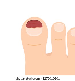Foot thumb cartoon vector. toe vector. wallpaper. free space for text. copy space. Tear nails.