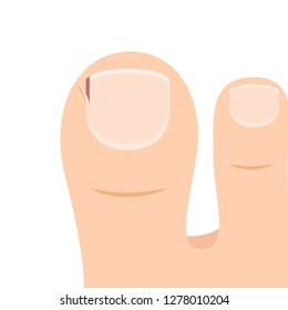 Cartoon Toes Images, Stock Photos & Vectors | Shutterstock