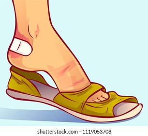 Footwear that rubs, vector illustration