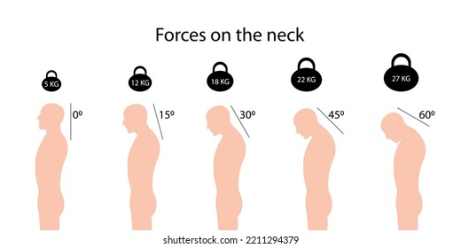 Forces On The Neck. Angles And Weights. Improper Posture Symptoms. Spinal Curvature