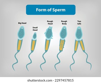 La forma o morfología del esperma