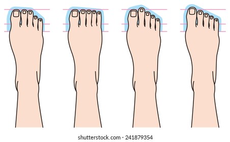 Form of toes