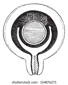 Formation of the decidua, vintage engraved illustration. Usual Medicine Dictionary - Paul Labarthe - 1885.