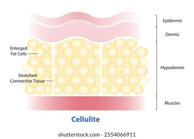 Formation of skin with cellulite vector illustration on white background. Enlarged fat cells push up against the skin. Stretched connective tissue pull down. The skin dimpling, looks like orange peel.