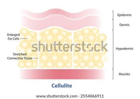 Formation of skin with cellulite vector illustration on white background. Enlarged fat cells push up against the skin. Stretched connective tissue pull down. The skin dimpling, looks like orange peel.