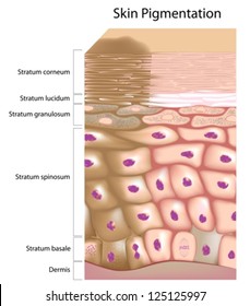 Formation of uneven skin tone