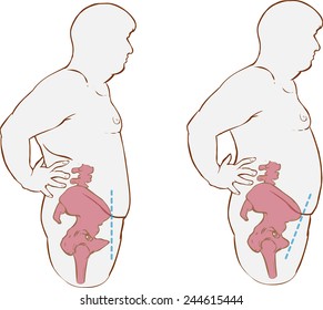 21 Pelvic tilt Stock Vectors, Images & Vector Art | Shutterstock