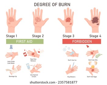 Vier Grad der Hautverbrennung mit verschiedenen Schäden und Verletzungen medizinischen Guide Infografik Poster. Erste Hilfe und Wundbehandlung, verbotene Maßnahmen zur Vermeidung einer Verschlechterung der Vektorgrafik