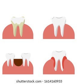 Four problems of tooth decay and gum problems 