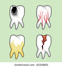 Four teeth affected by various diseases