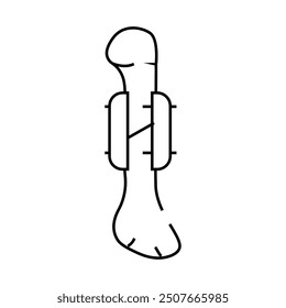 fracture bone treatment line icon vector. fracture bone treatment sign. isolated contour symbol black illustration