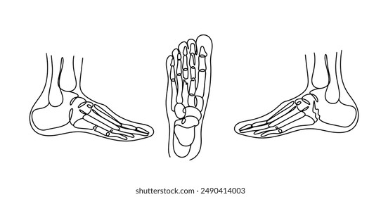 Fractures of human foot bones. Fractures in different places of the leg due to injury. Vector illustration.