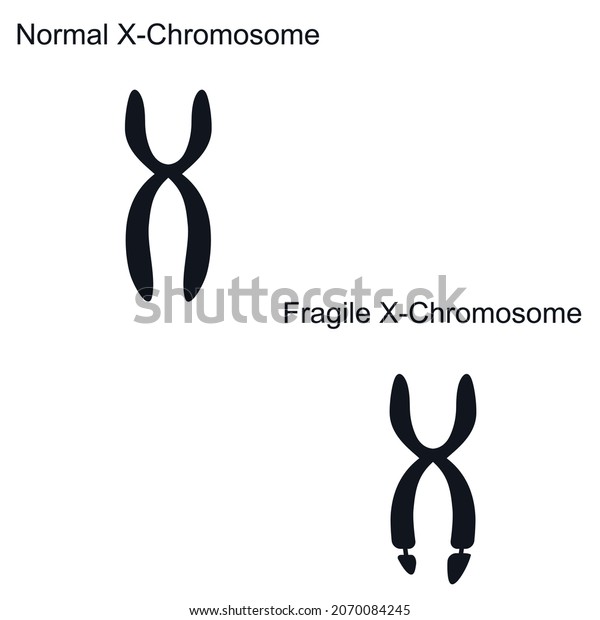 Fragile X Syndrome Genetics Logo Icon Stock Vector (Royalty Free ...