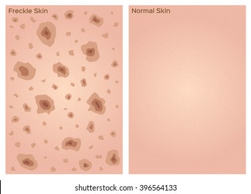 freckle skin texture graphic , vector , nice skin