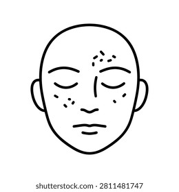 Freckles Face Icon Containing freckles, facial pigmentation, skincare, and outline icon. Outline icon