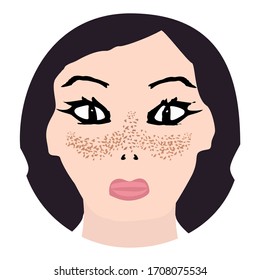 Freckles on the face. Pigmentation on the skin. A pigmented spot on the skin of the face. Before and after treatment. Vector illustration