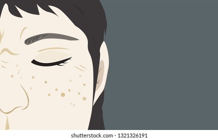 Freckles on lady face