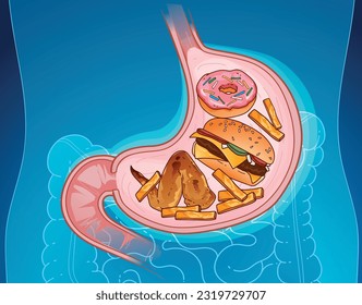 Fried food, heavy food, fast food. Digestion of food. Human stomach. Health care illustration, vector illustration.