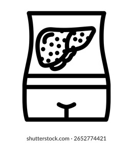 friedreichs ataxia disease line icon vector. friedreichs ataxia disease sign. isolated contour symbol black illustration