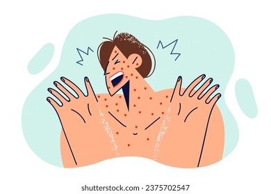 Frightened woman with allergy rash on face and body screams, needing doctor help or taking medication. Girl with bare shoulders has chickenpox or allergy caused by eating exotic food.