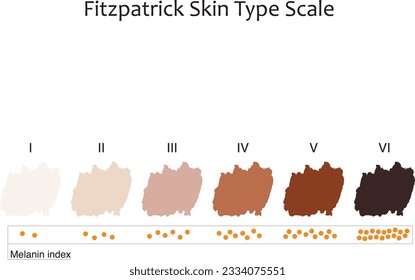 Fritzpatrick skin types. Human skin tones. Skin colors. 