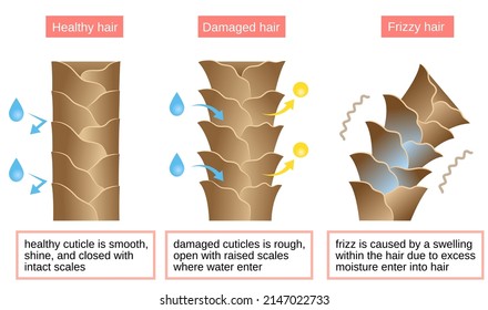 frizz is caused by absorbing excess moisture due to damaged cuticle. Illustration of Healthy and damaged hair cuticle function as the protective layer.  Beauty hair care concept