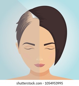 Front view of a balding woman before and after hair treatment. Divided image of the head. Two halves. Sticker revealing healthy scalp. Female alopecia. Isolated vector illustration.