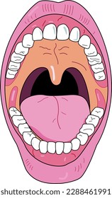 Front view of the inside of a human mouth