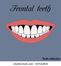 Frontal teeth - incisor, canine, premolar, molar upper and lower jaw. Vector illustration for print or design of the dental clinic