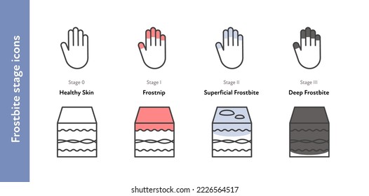 Frostbite anatomical icon set. Vector flat healthcare illustration. Stages of hypothermia. Skin layer and hand with finger symbol. Frostnip, superficial, deep stage. Design for infographic dermatology