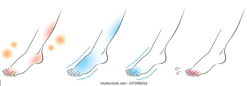 frostbite feet and cold feet