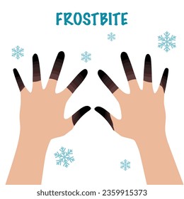 Frostbite is injury to body tissues caused by exposure to extreme cold, typically affecting the nose, fingers, or toes and sometimes resulting in gangrene.