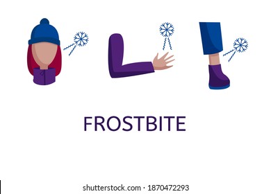 Frostbite, woman body sensitivity to cold, vector illustration with text on white background