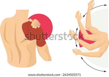 Frozen shoulder, medically known as adhesive capsulitis, is a condition characterized by stiffness, pain, and limited range of motion in the shoulder joint.