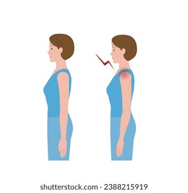Frozen shoulder, woman lying sideways with shoulder pain due to periarthritis
