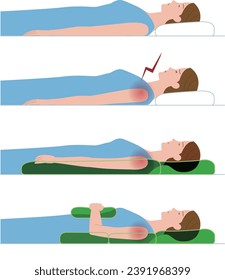 Frozen shoulder.periarthritis. A woman can't sleep because of shoulder pain at night. An example of how to sleep to relieve pain